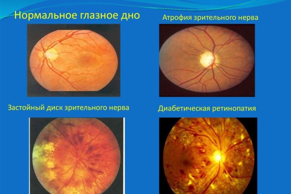Кракен сайт продаж